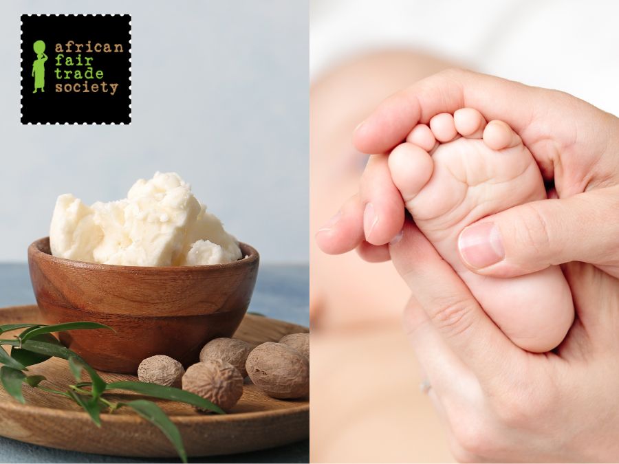 Can You Use Shea Butter on Baby Skin?