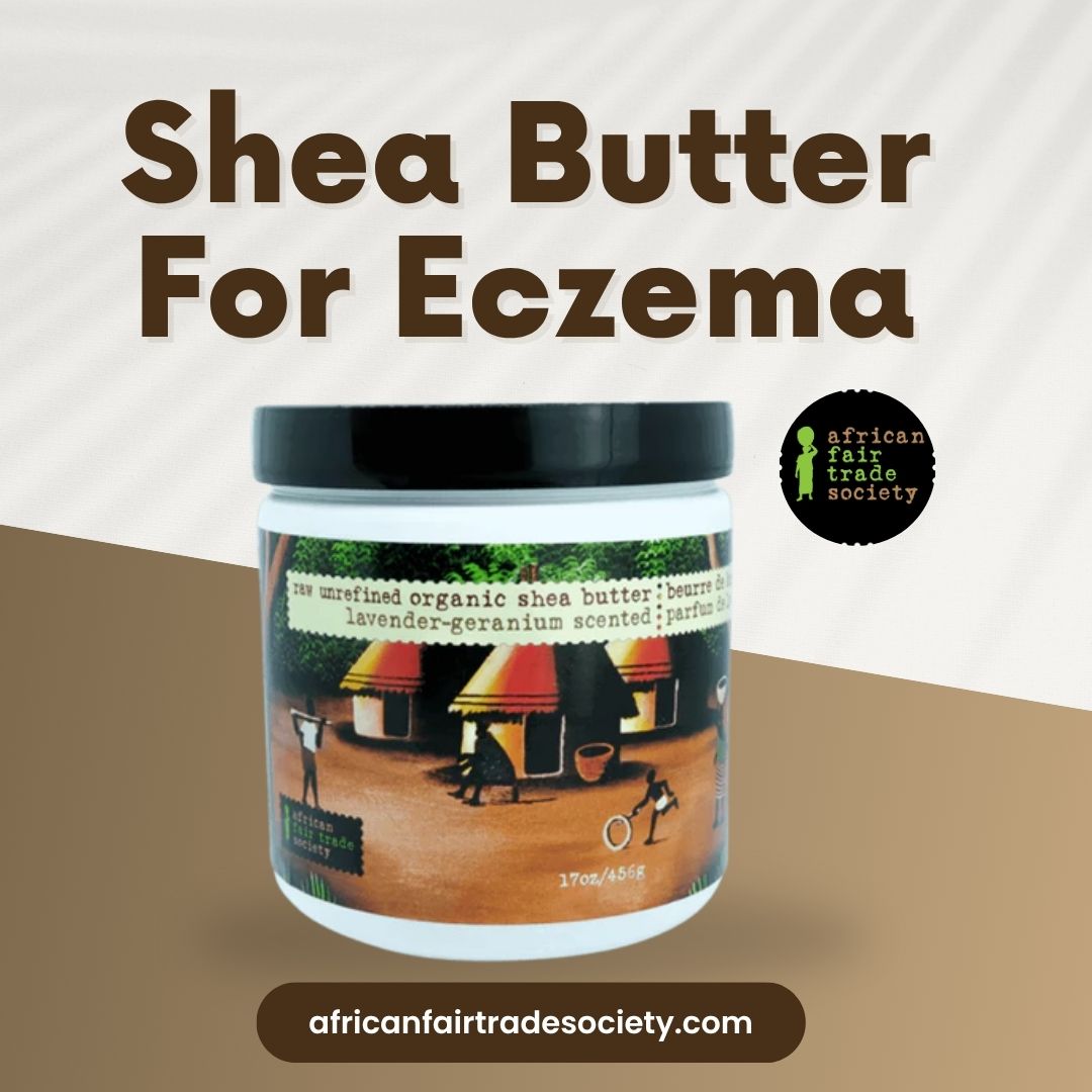 Shea Butter For Eczema