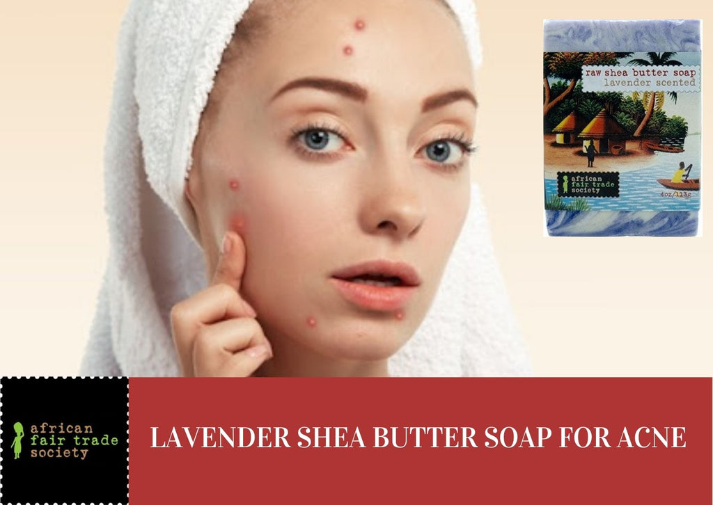 Why Consider a Lavender Shea Butter Soap for Treating Acne Scars?