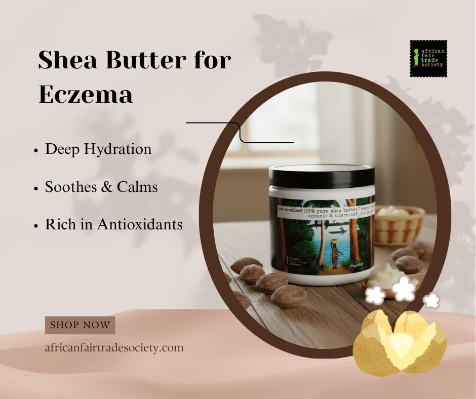 Shea Butter for Eczema